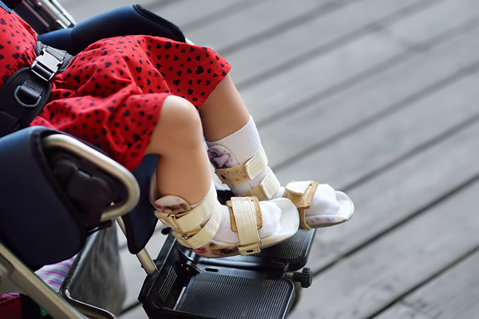 Disabled girl sitting in wheelchair. On her legs orthopedic equipment . Child cerebral palsy. Inclusion. Family with disabled kid.